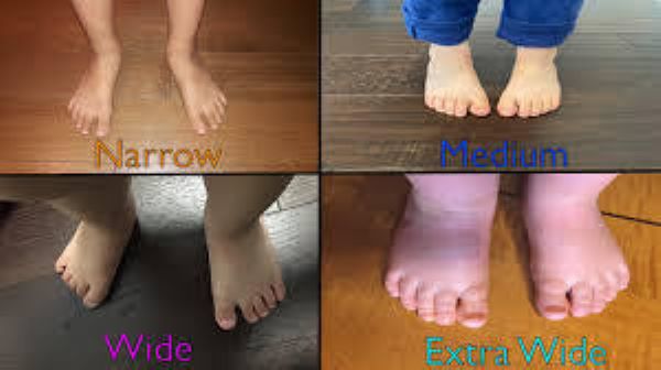 široka stopala