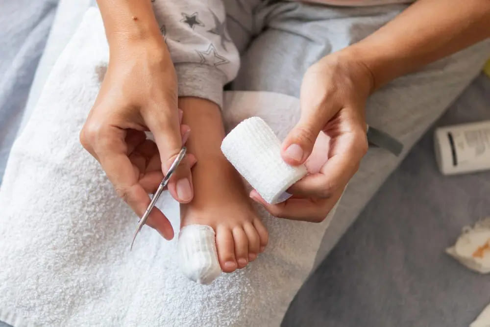 urasli nokti kod beba i dece